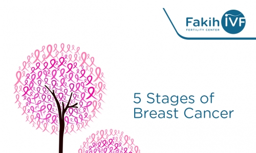 5 مراحل لسرطان الثدي