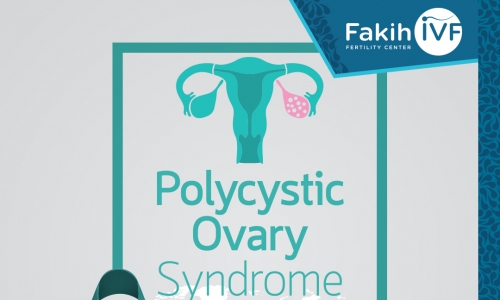 Link between food and PCOS
